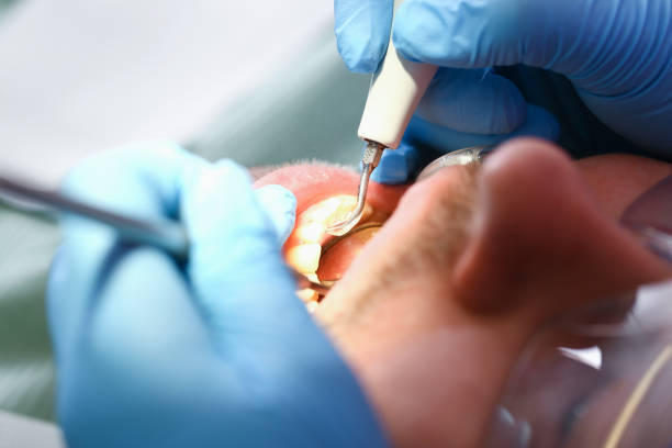 Best Broken or Cracked Tooth Emergency Dentist in Dale, PA